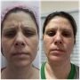 Foto 1:  Estética Rachel Lilás