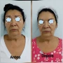 Foto 1:  Estética Rachel Lilás