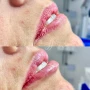 Foto 1:  Estética Rachel Lilás