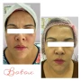 Foto 1:  Estética Rachel Lilás